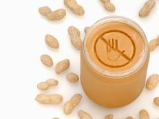 Peanut allergy