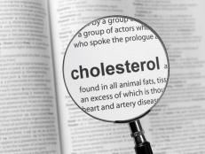 When it comes to our cholesterol, there’s a lot of confusing information out there. Here are questions about cholesterol that dietitians are often asked.